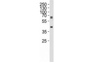 Western blot analysis of 293 lysate using SET07 antibody at 1:1000.