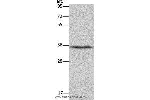 Western blot analysis of Human fetal liver tissue, using DDAH1 Polyclonal Antibody at dilution of 1:400 (DDAH1 抗体)