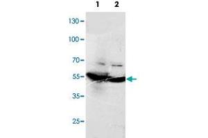 Western blot analysis of tissue lysates with DLD polyclonal antibody . (DLD 抗体  (C-Term))