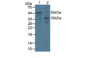 Western blot analysis of (1) Human Jurkat Cells and (2) Human A431 Cells. (DOK3 抗体  (AA 128-385))