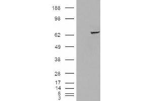 Western Blotting (WB) image for anti-Insulin-Like Growth Factor 2 mRNA Binding Protein 2 (IGF2BP2) antibody (ABIN5921444) (IGF2BP2 抗体)