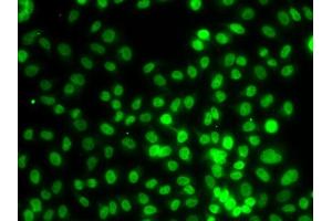 Immunofluorescence analysis of MCF-7 cells using KMT5A/KMT5A/SETD8 antibody (ABIN6132563, ABIN6147653, ABIN6147654 and ABIN6223142).