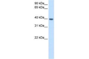 Western Blotting (WB) image for anti-Integrin beta 1 Binding Protein (Melusin) 2 (ITGB1BP2) antibody (ABIN2462574)