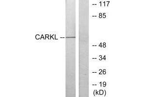Western blot analysis of extracts from Jurkat cells, using CARKL antibody. (SHPK 抗体  (N-Term))