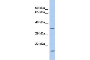WB Suggested Anti-ASPDH Antibody Titration: 0. (ASPDH 抗体  (Middle Region))