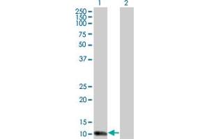 Western Blot analysis of S100A7 expression in transfected 293T cell line by S100A7 monoclonal antibody (M02), clone 1A4.