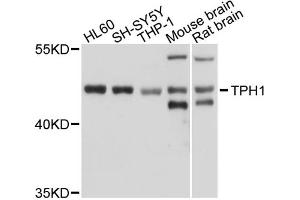 Western blot analysis of extracts of various cell lines, using TPH1 antibody (ABIN5970750) at 1/1000 dilution. (Tryptophan Hydroxylase 1 抗体)