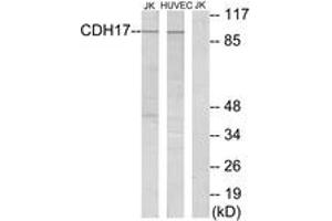 Western blot analysis of extracts from Jurkat/HuvEc cells, using CDH17 Antibody. (LI Cadherin 抗体  (AA 341-390))