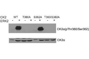 Western blot of CK2a(Phospho- Thr360/Ser362) antibody and CK2a antibody in vitro kinase assay. (CSNK2A1/CK II alpha 抗体  (pSer362, pThr360))