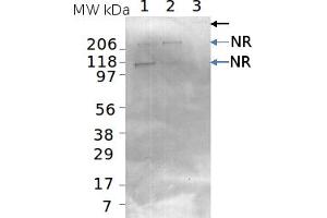 Image no. 1 for anti-Nitrate Reductase, Assimilatory (NR) antibody (ABIN334562) (Nitrate Reductase 抗体)