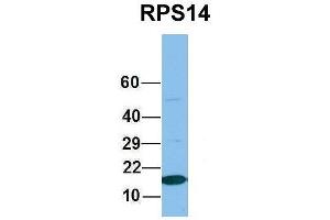 Western Blotting (WB) image for anti-Ribosomal Protein S14 (RPS14) (Middle Region) antibody (ABIN2778744)