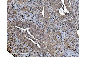 IHC analysis of REA/PHB2 using anti-REA/PHB2 antibody (ABIN7599239). (Prohibitin 2 抗体  (AA 1-299))