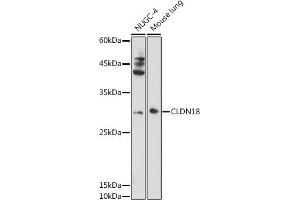Western blot analysis of extracts of various cell lines, using CLDN18 antibody (ABIN6127701, ABIN6138681, ABIN6138682 and ABIN6224437) at 1:1000 dilution. (Claudin 18 抗体  (AA 20-80))