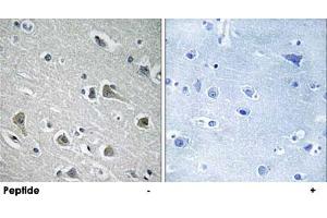 Immunohistochemistry analysis of paraffin-embedded human brain tissue using MYLIP polyclonal antibody . (MYLIP 抗体)