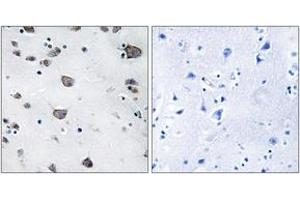 Immunohistochemistry (IHC) image for anti-Apoptosis-Inducing Factor, Mitochondrion-Associated, 3 (AIFM3) (AA 10-59) antibody (ABIN2889860) (AIFM3 抗体  (AA 10-59))