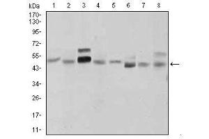 Image no. 4 for anti-Sonic Hedgehog (SHH) antibody (ABIN1491290) (Sonic Hedgehog 抗体)