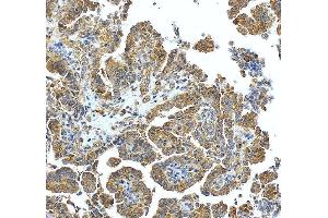 anti-Sorting Nexin 6 (SNX6) (AA 1-406) antibody