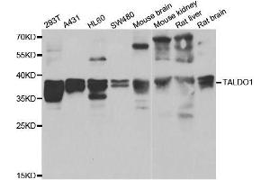 Western blot analysis of extracts of various cell lines, using TALDO1 antibody. (TALDO1 抗体  (AA 1-337))