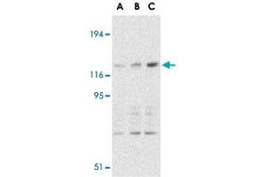 Western blot analysis of CARD11 expression in mouse thymus tissue lysate with CARD11 polyclonal antibody  at 0. (CARD11 抗体  (C-Term))