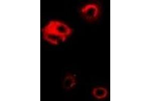Immunofluorescent analysis of PGK1 staining in Hela cells. (PGK1 抗体)