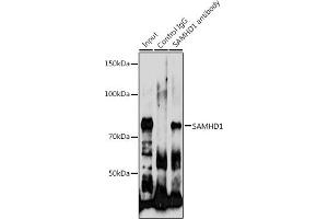 Immunoprecipitation (IP) image for anti-SAM Domain and HD Domain 1 (SAMHD1) (AA 387-626) antibody (ABIN6147368)