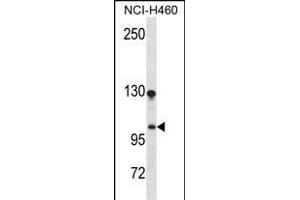 DLG Antibody (N-term) (ABIN1539122 and ABIN2850094) western blot analysis in NCI- cell line lysates (35 μg/lane). (DLGAP3 抗体  (N-Term))