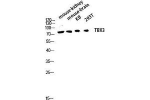 Western Blot (WB) analysis of Mouse Kidney Mouse Brain KB 293T lysis using TBX3 antibody. (TBX3 抗体  (Internal Region))