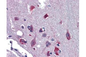 Immunohistochemistry (IHC) image for anti-Nuclear Receptor Subfamily 2, Group E, Member 1 (NR2E1) (N-Term) antibody (ABIN2779454)