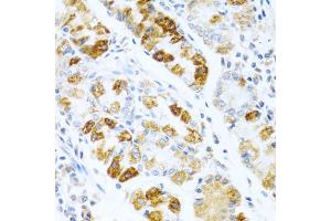 Immunohistochemistry of paraffin-embedded human stomach using BMP3 antibody (ABIN5975705) at dilution of 1/100 (40x lens). (BMP3 抗体)