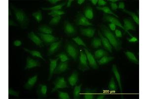 Immunofluorescence of monoclonal antibody to PIK3R4 on HeLa cell. (PIK3R4 抗体  (AA 1259-1358))