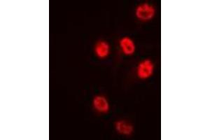 Immunofluorescent analysis of Histone Deacetylase 1 staining in HeLa cells. (HDAC1 抗体  (C-Term))