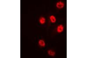 Immunofluorescent analysis of Histone Deacetylase 1 staining in HeLa cells.