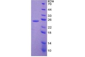 SDS-PAGE of Protein Standard from the Kit  (Highly purified E. (IL-6 ELISA 试剂盒)