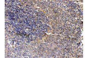IHC analysis of Thrombopoietin using anti- Thrombopoietin antibody . (Thrombopoietin 抗体  (AA 22-259))