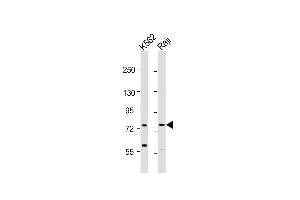Western Blotting (WB) image for anti-ATP-Binding Cassette, Sub-Family B (MDR/TAP), Member 10 (ABCB10) (AA 1-27), (N-Term) antibody (ABIN652180)
