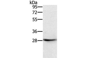 Western Blot analysis of Human normal colon tissue using RAB8B Polyclonal Antibody at dilution of 1:400 (RAB8B 抗体)