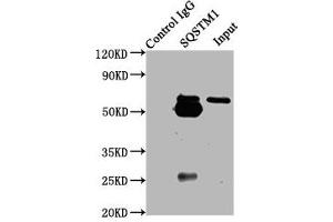 Immunoprecipitating SQSTM1 in Hela whole cell lysate Lane 1: Rabbit control IgG (1 μg) instead of ABIN7168871 in Hela whole cell lysate.