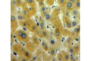 Used in DAB staining on fromalin fixed paraffin-embedded Liver tissue (CAMKII gamma 抗体  (AA 75-281))