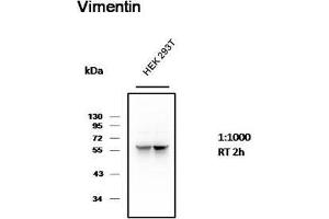 Western Blot (WB) analysis of 293T cell with Mouse Monoclonal Antibody diluted at 1:1000. (Vimentin 抗体)