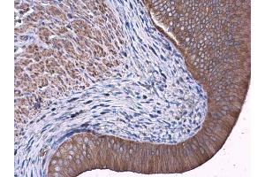 IHC-P Image FAK antibody detects FAK protein at cytoplasm in rat cervix by immunohistochemical analysis. (FAK 抗体  (C-Term))