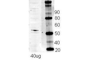 NRF1 antibody - N-terminal region  validated by WB using Mouse endothelial cells at 1:500.