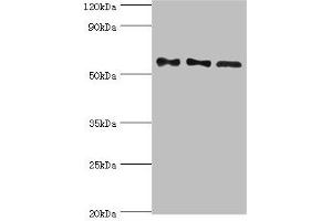 Western blot All lanes: Serine/threonine-protein phosphatase 2B catalytic subunit gamma isoform antibody at 10 μg/mL Lane 1: Rat brain tissue Lane 2: MCF-7 whole cell lysate Lane 3: Rat skeletal muscle tissue Secondary Goat polyclonal to rabbit IgG at 1/10000 dilution Predicted band size: 59, 58, 60 kDa Observed band size: 59 kDa (PPP3CC 抗体  (Catalytic Subunit gamma))