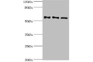 PPP3CC 抗体  (Catalytic Subunit gamma)