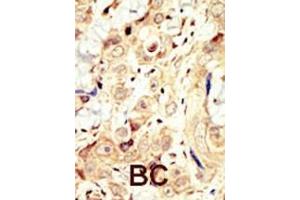 Immunohistochemistry (Paraffin-embedded Sections) (IHC (p)) image for anti-V-Erb-A erythroblastic Leukemia Viral Oncogene Homolog 4 (Avian) (ERBB4) (AA 25-55), (N-Term) antibody (ABIN391950)