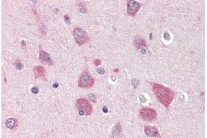 Human Brain, Cortex (formalin-fixed, paraffin-embedded) stained with MYO5B antibody ABIN396915 at 20 ug/ml followed by biotinylated goat anti-rabbit IgG secondary antibody ABIN481713, alkaline phosphatase-streptavidin and chromogen. (MYO5B 抗体  (C-Term))