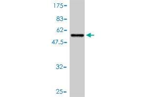 Western Blot detection against Immunogen (53. (14-3-3 sigma/SFN 抗体  (AA 1-248))
