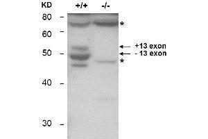 Western Blotting (WB) image for anti-Bridging Integrator 1 (BIN1) antibody (ABIN1043740) (BIN1 抗体)