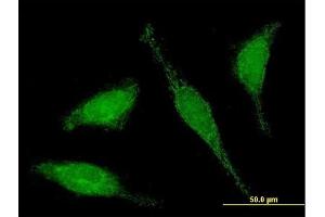 Immunofluorescence of purified MaxPab antibody to C6orf206 on HeLa cell. (RSPH9 抗体  (AA 1-276))