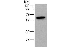 Western blot analysis of Mouse testis tissue lysate using SCP2 Polyclonal Antibody at dilution of 1:350 (SCP2 抗体)