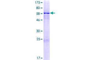 ZIK1 Protein (AA 1-384) (GST tag)